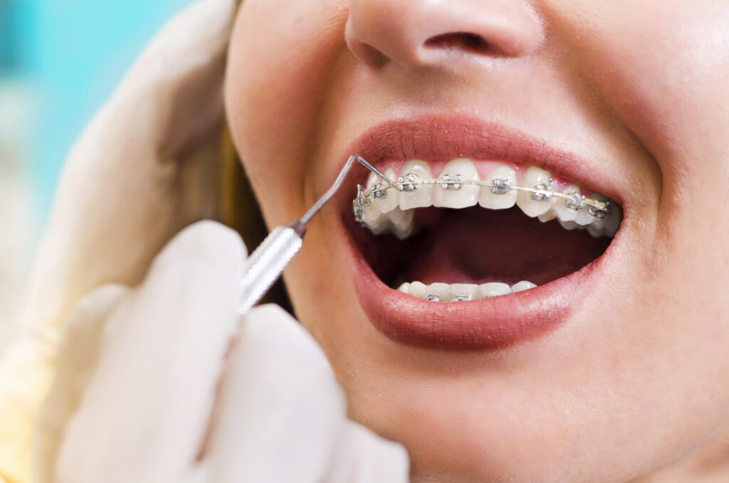 a routine dental checkup of a girl wearing braces