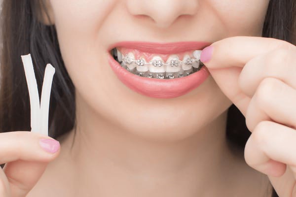 a girl using wax on her braces