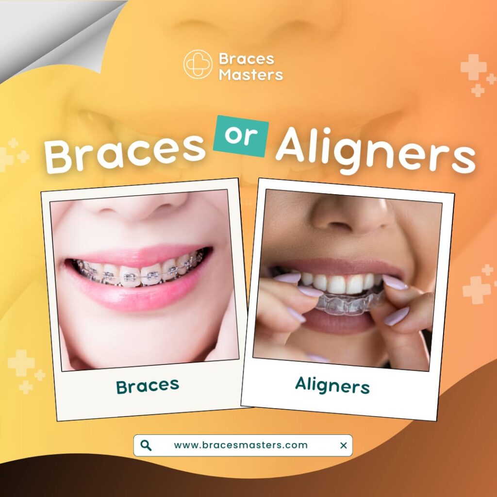 a picture of two girls that wearing braces and aligners